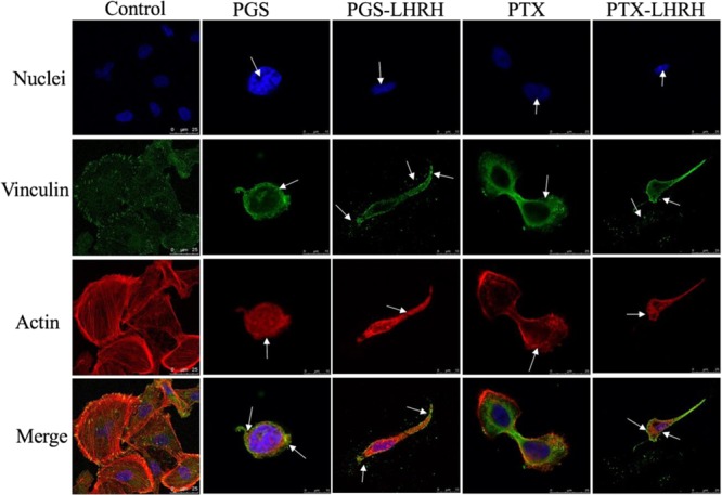 Confocal fluorescence images showing cellular uptake and cytotoxicity comparison of MDA-MB-231 cells 6 hours after their incubation with PGS, PGS-LHRH, PTX or PTX-LHRH. (OA Literature)