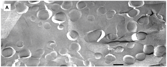 Fig.1 Picture of 1/POPC/PEG-ceramide fliposomes. (OA Literature)