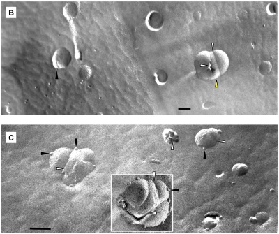 Fig.2 Upon decrease of pH from 7.4 to 5.5, the 1/POPC/PEG-ceramide fliposomes underwent drastic morphological transformations. (Samoshina, Nataliya M et al.,2011)