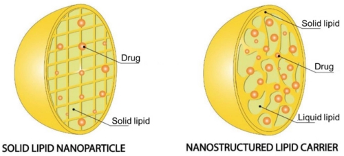 Fig.1 Schematic of structural matrix of SLN and NLC. (OA Literature)