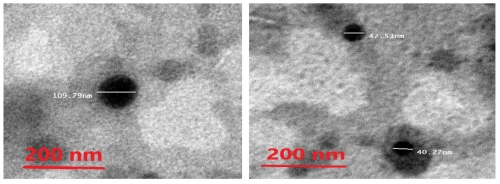 Fig.2 Photomicrograph of the optimal metformin-loaded ethosome formula as seen by the TEM. (Mousa, Ibrahim A et al., 2022)