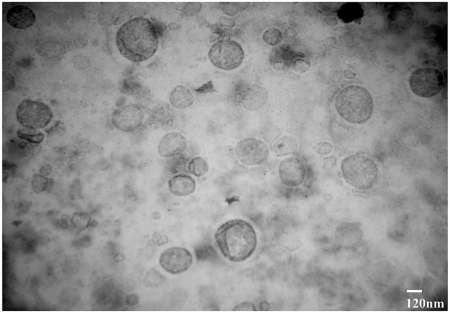Fig.3 TEM micrograph of the optimized TAEG formulation (TA-5). Scale bar is indicated. (Akhtar, Naheed et al., 2022)