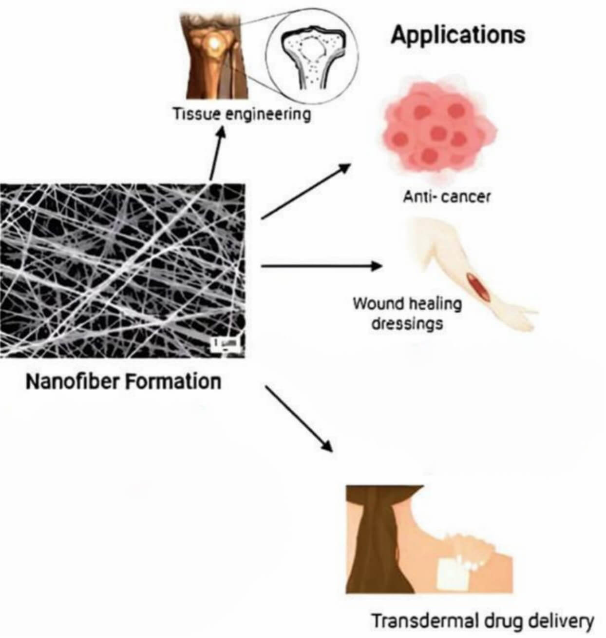 Illustration of the biomedical applications of electrospun polymeric nanofibers (EPNFs)—nanofiber formation supporting tissue engineering, anti-cancer delivery, wound-healing dressings, and transdermal drug delivery. (OA Literature)