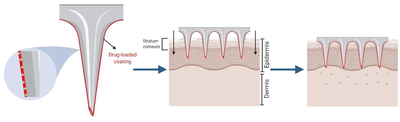 Illustration of the 'coat and poke' approach with coated microneedles: A drug-loaded coating on microneedles penetrates the stratum corneum, then dissolves to deliver the active ingredient into the skin, as part of microneedle-based drug delivery strategies. (OA Literature)