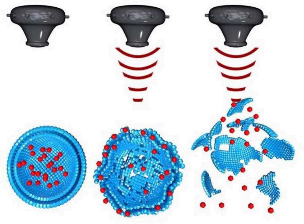 Fig.1 Illustration of the mechanism of ultrasound-responsive nanoparticles for targeted drug delivery: Shows a sequence (top to bottom, left to right): an ultrasound transducer, ultrasound waves emitted toward a drug-loaded nanoparticle (blue structure encapsulating red therapeutic molecules), then the nanoparticle responding to ultrasound by disassembling, and finally releasing the red drug payloads. (OA Literature)