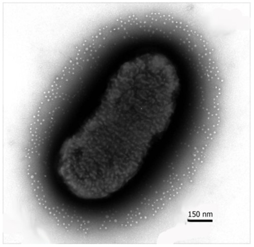 Accumulations of numerous extracellular membrane nanovesicles on the surface, outside of bacterial cell, is presented. (OA Literature)