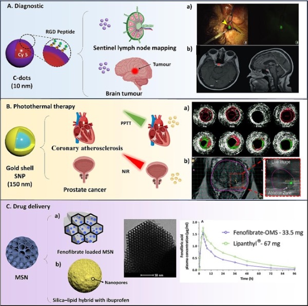 Human studies using different types of silica nanoparticles (SNP) for application in diagnostic, tumour ablation and drug delivery. (OA Literature)