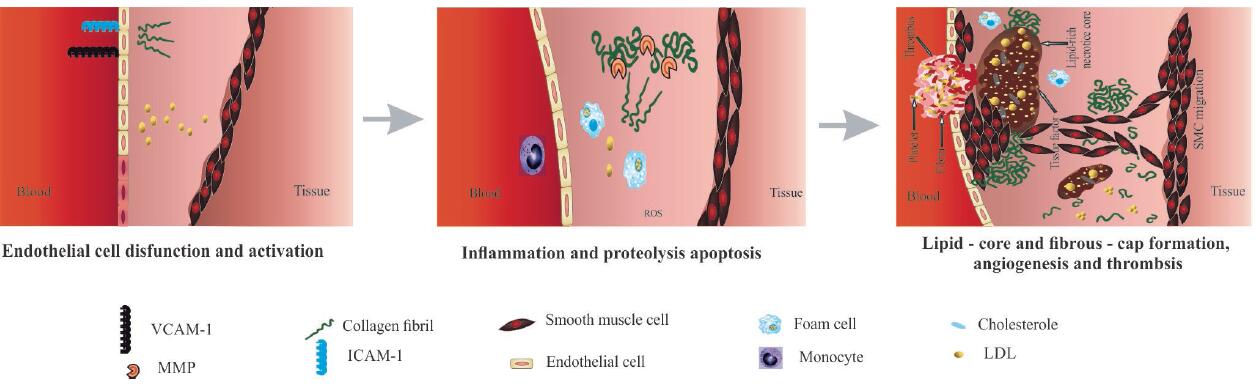 Fig.1 Atherosclerosis initiation and progression process. (Nakhlband, Ailar, et al, 2018)