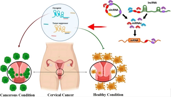 Fig.1 The role of lncRNAs and circRNAs in cervical cancer. (Heidari-Ezzati, Sama, et al, 2024)