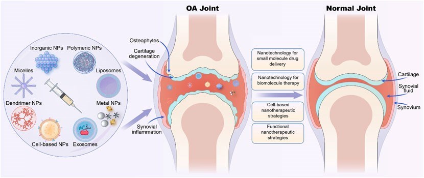 Fig.2 Various nano-therapeutic strategies based on different nanoparticles for osteoarthritis (OA) treatment. (Guo, Xinjing, et al, 2022)
