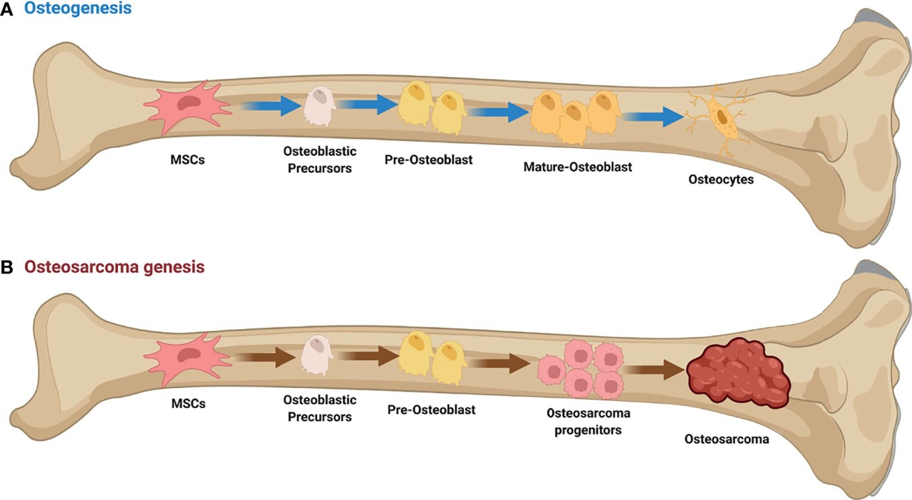 Fig.1 Osteogenesis and Osteosarcoma genesis. (Xie, Duoli, et al, 2022)