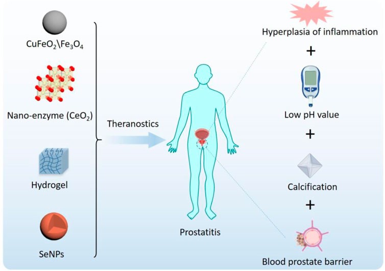 Fig.1 Smart nanoparticles for prostatitis. (Liu, Chun-Ping, et al, 2021)