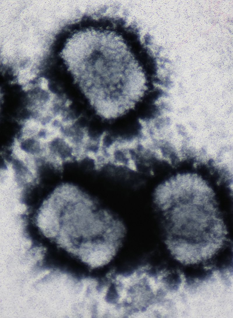 Electron micrograph of three cowpox virus particles