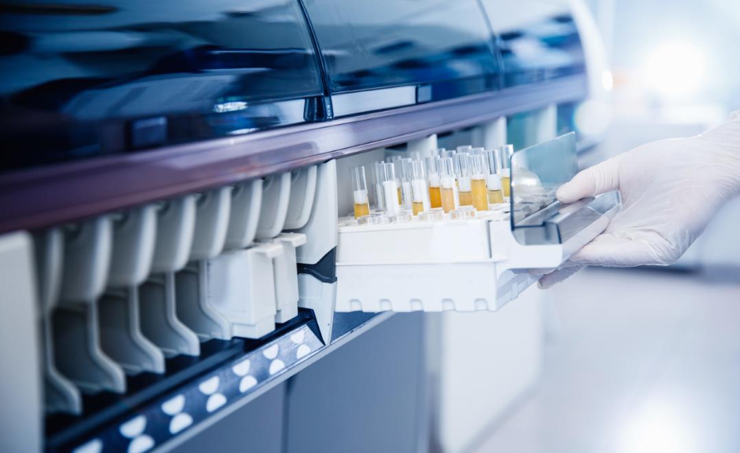 Design of HBV immunogen and analytical results of its in vitro protein expression.