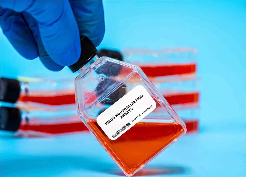A slide illustrating the Cell and Virus Neutralization Tests as part of the Vaccine Analytical Development & Qualification Solution.