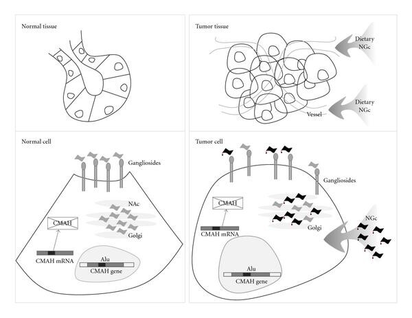 Schematic overview of NGc ganglioside functions in human tumor biology.