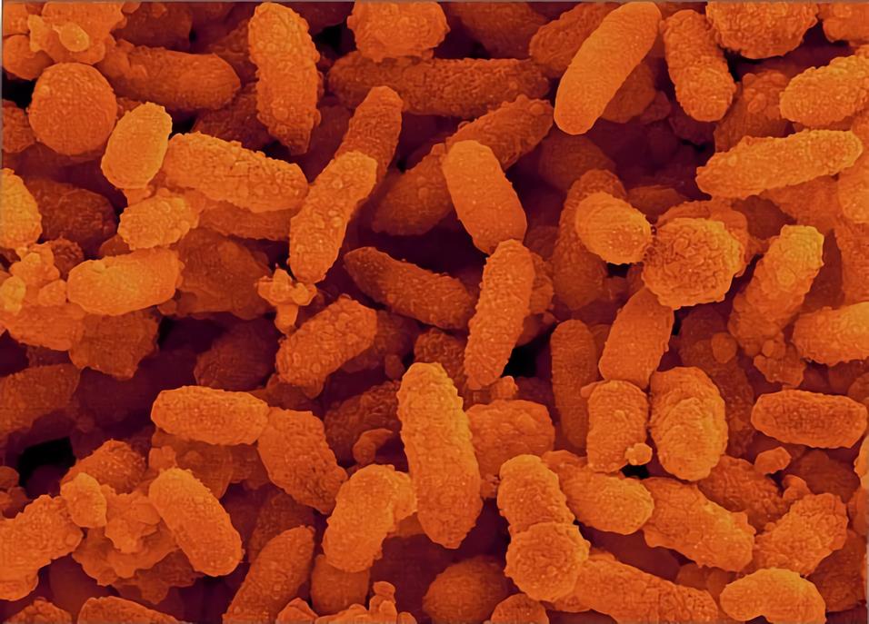 Aeromonas hydrophila Vaccines - Creative Biolabs