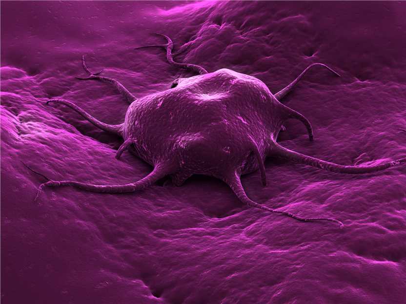 Tumor Cells – Creative Biolabs