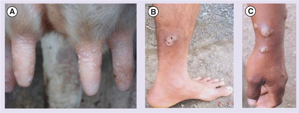 Typical buffalopox lesions