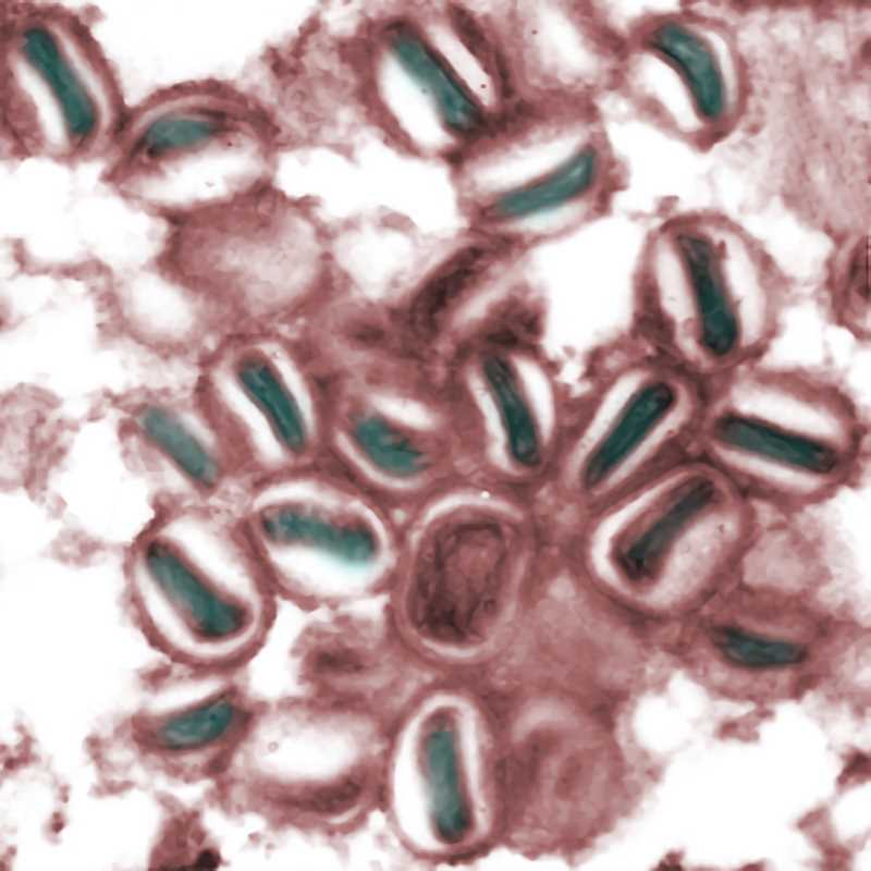 Fowlpox Virus