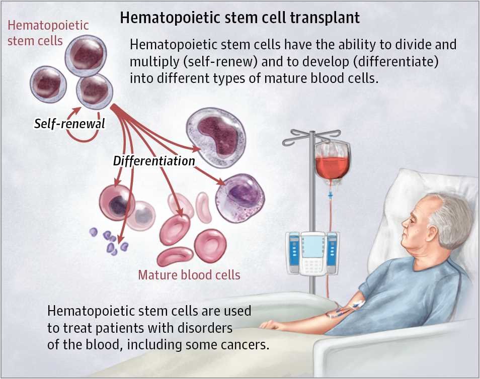 Hematopoietic Stem Cell Transplantation - Creative Biolabs