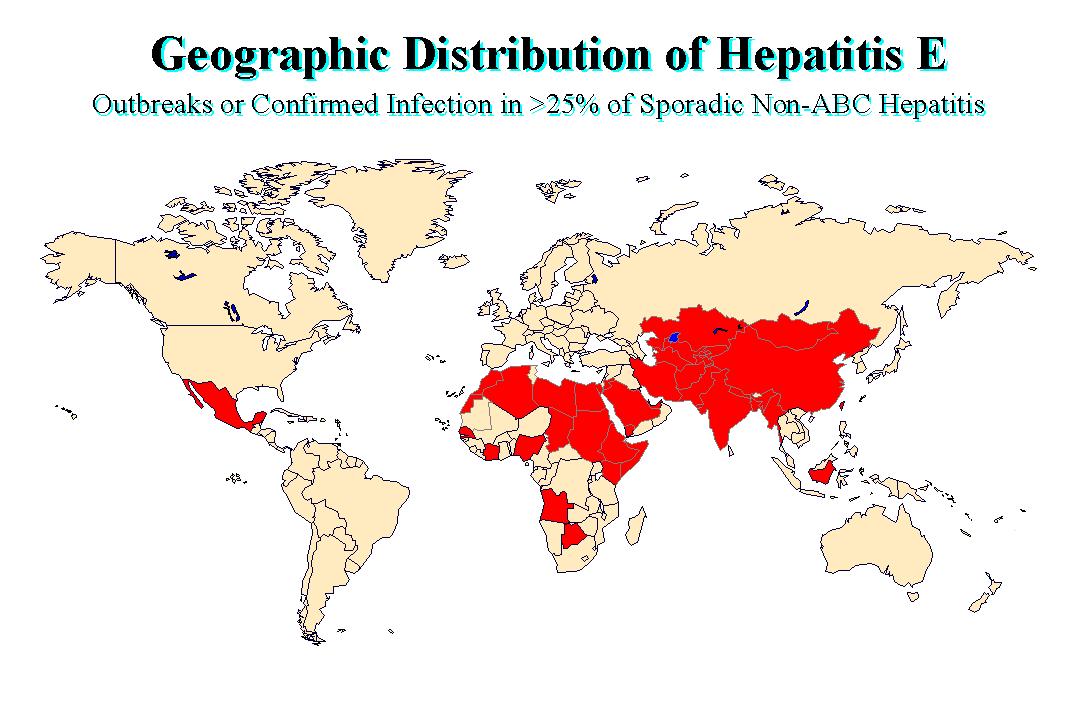 Geographic distribution of Hepatitis E.