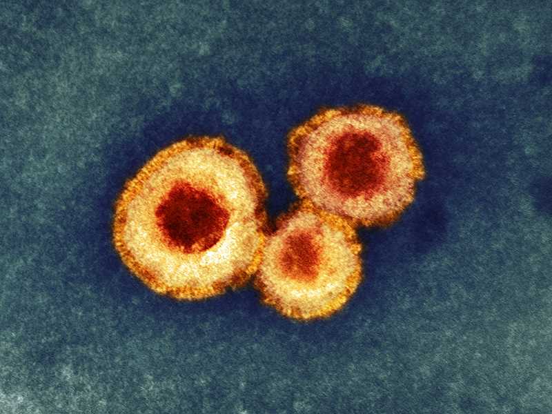 Human metapneumovirus - Creative Biolabs