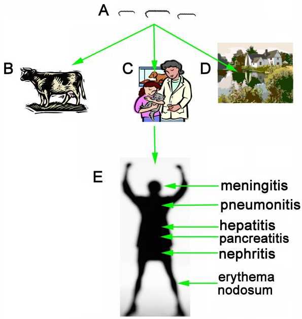 Fig. 1 The transmission route of Leptospire's infection. (Wang, Zhijun, Li Jin, & Alicja Węgrzyn., 2007) (OA Literature)
