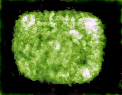 Brick-Like Structure Typical of Poxviridae Viruses.