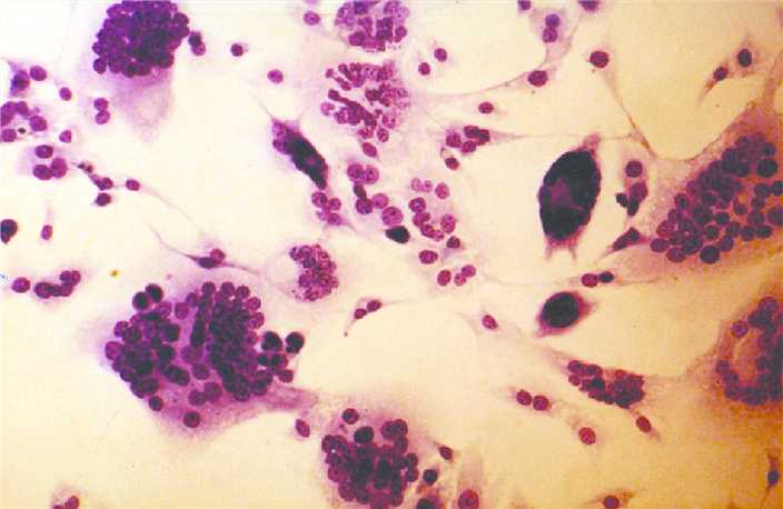 Maedi Visna Virus Vaccine Creative Biolabs