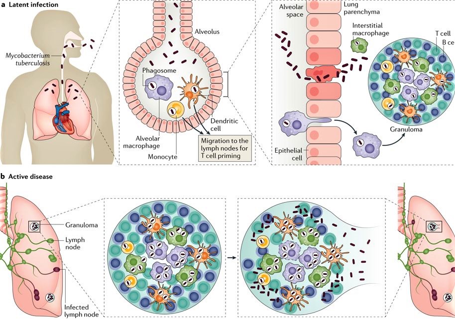 The Infection Mechanism of Mycobacterium tuberculosis