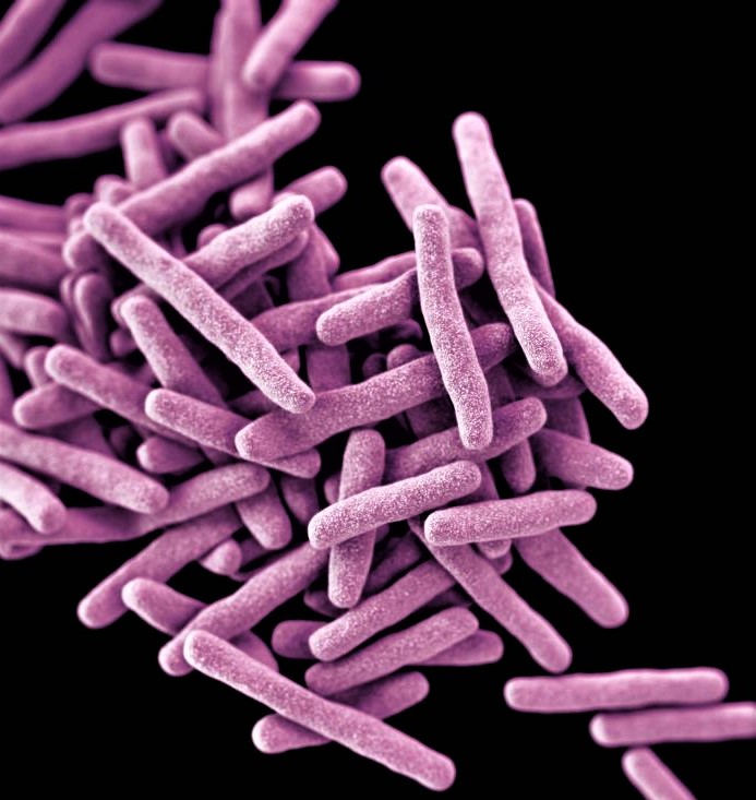 Mycobacterium tuberculosis - Creative Biolabs