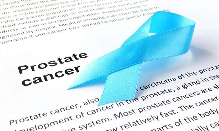 Prostate Cancer - Creative Biolabs