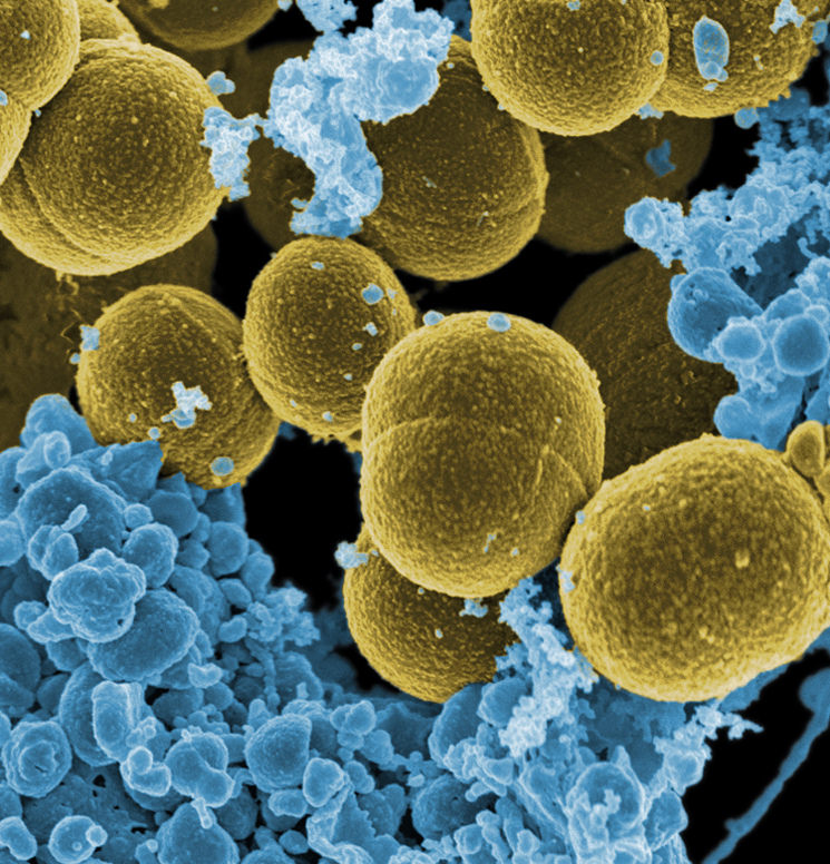 Fig. 1 Staphylococcus aureus bacteria.