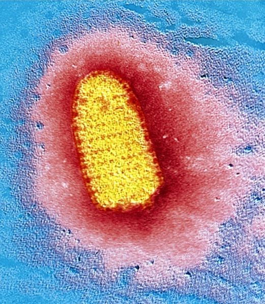 Rabies virus – Creative Biolabs.