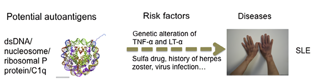The potential autoantigens and risk factors (both genetic and environmental) of systemic lupus erythematosus. TNF-ɑ: tumor necrosis factor; LT-ɑ: Lymphotoxin-ɑ.