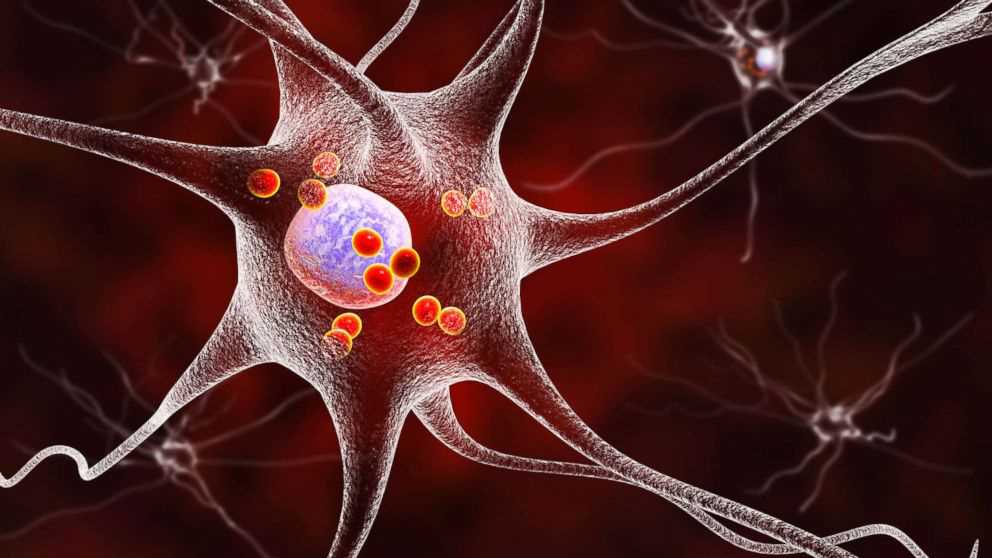Neurons – Creative Biolabs