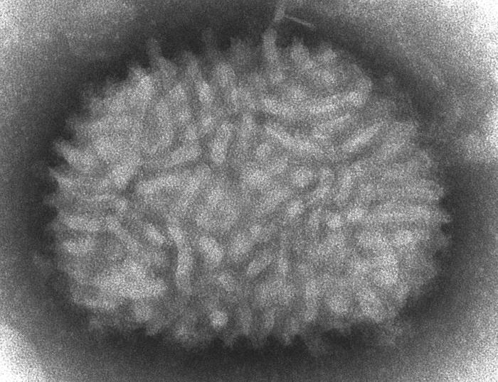 Fig. 1 Vaccinia virus.