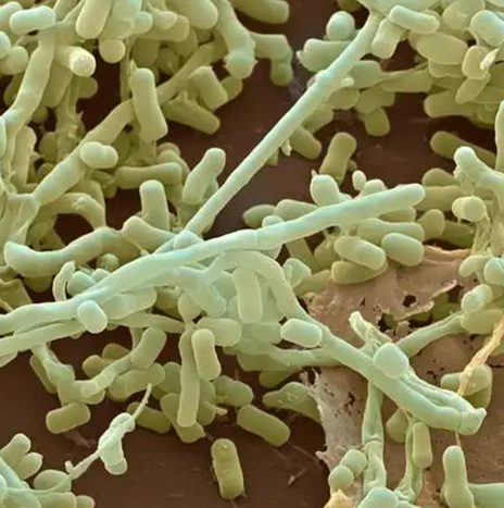 Vaccine Target Validation