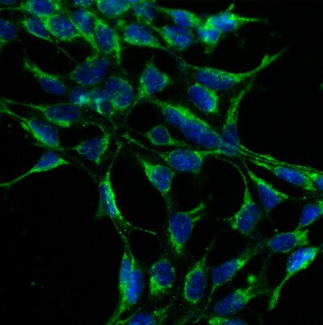 Vaccine Target Validation