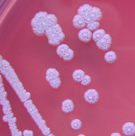 Vaccine Target Validation